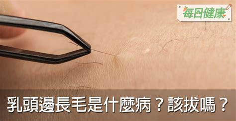 胸部有毛|乳頭邊長了毛，是什麼病？該不該拔？讓名醫一次解釋給您聽｜每